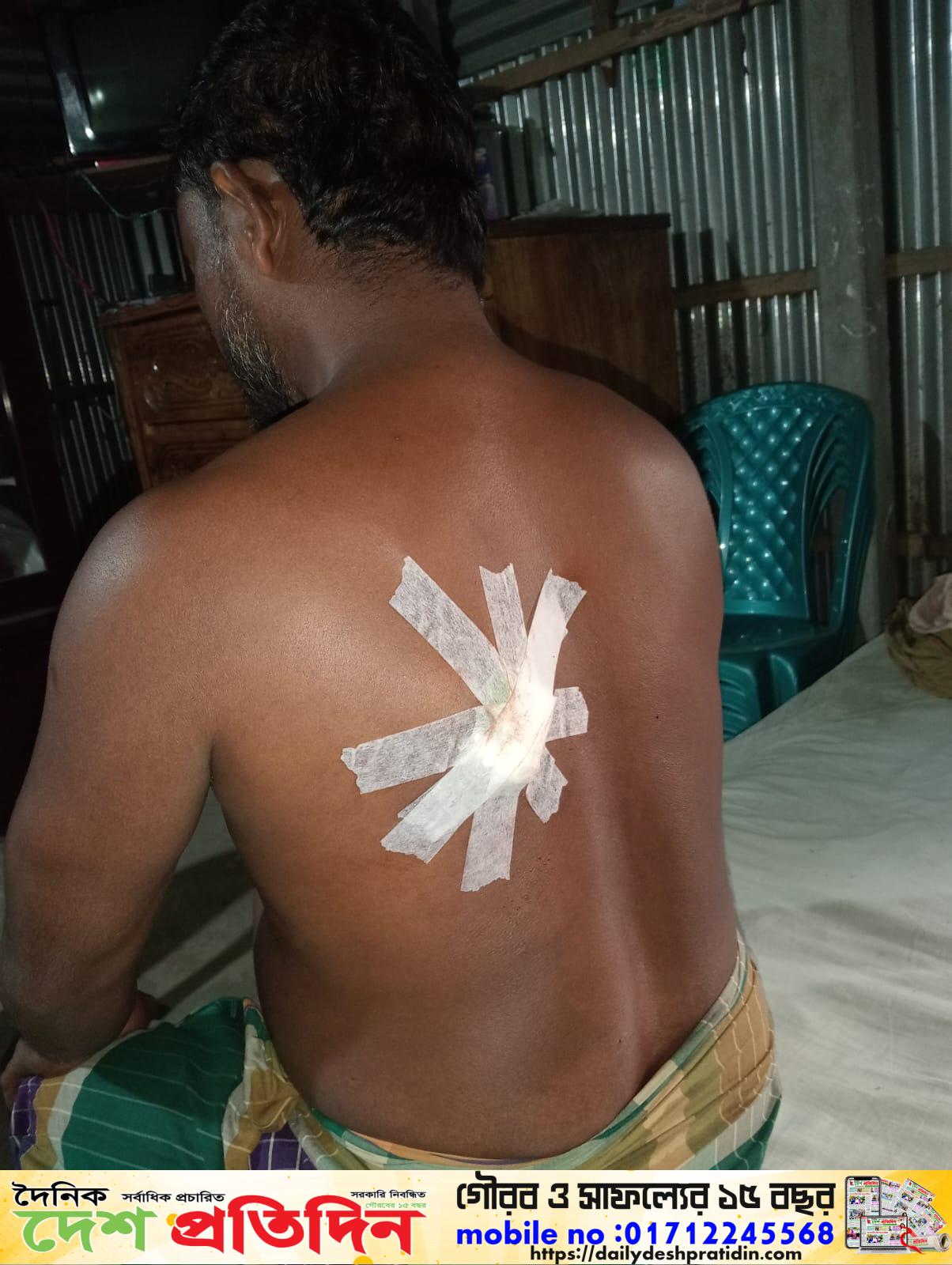 পুর্ব শত্রুতার জের ধরে ছুরিকাঘাত