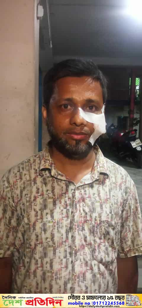চট্টগ্রাম জেলার সন্দ্বীপ উপজেলায় সড়ক নির্মাণে অনিয়মের প্রতিবাদ করায় এলজিইডি কর্মকর্তাদের মারধর
