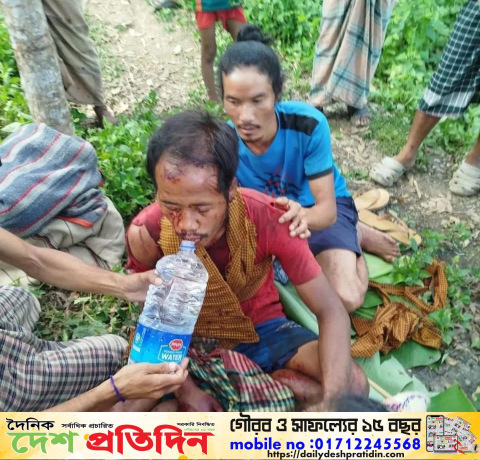 কলাগাছ কাটার সময় ভাল্লুকের আক্রমণে জুমচাষি আহত