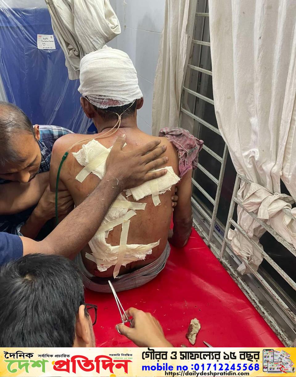 নোয়াখালীতে জেলা পরিষদের সাবেক সদস্যকে কুপিয়ে জখম