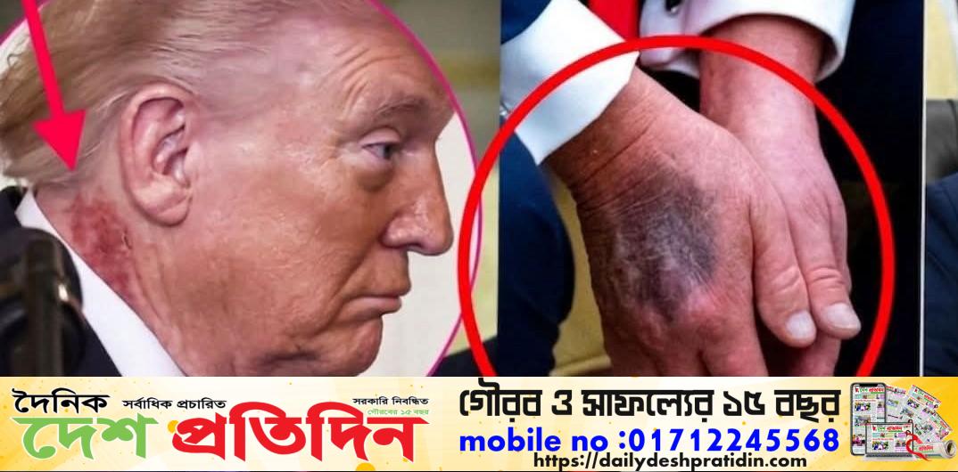 ট্রাম্পের সাম্প্রতিক কিছু ছবি বিশ্বজুড়ে তোলপাড় সৃষ্টি করেছে